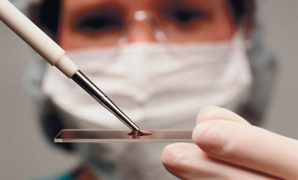 Blood test for parasites