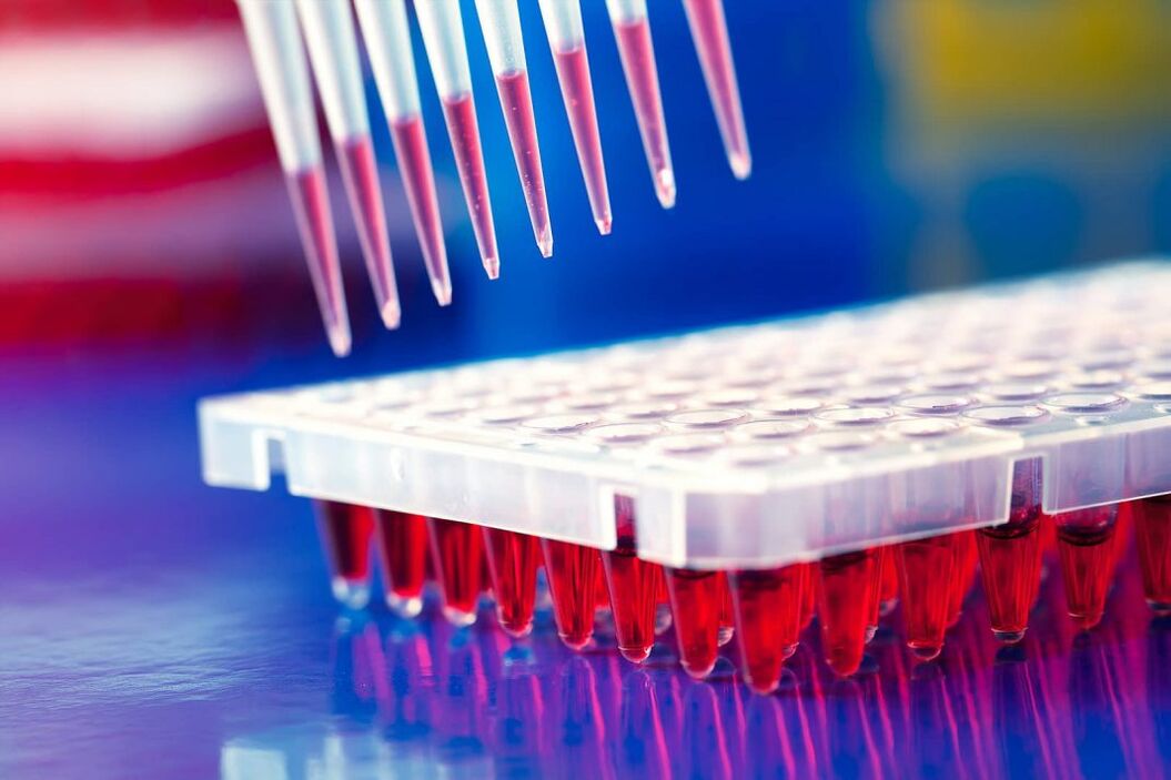 Immunoassay blood test for parasites