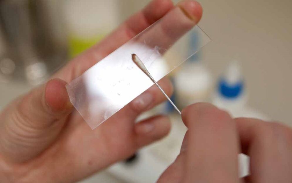Scratching for the presence of parasites in the body