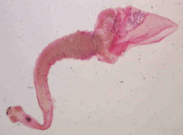 Pork tapeworm from humans