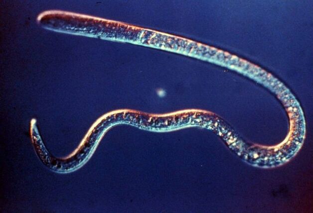 Trichinae from the human body